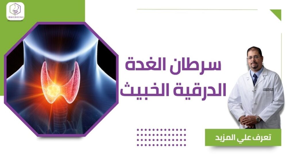 سرطان الغدة الدرقية الخبيث