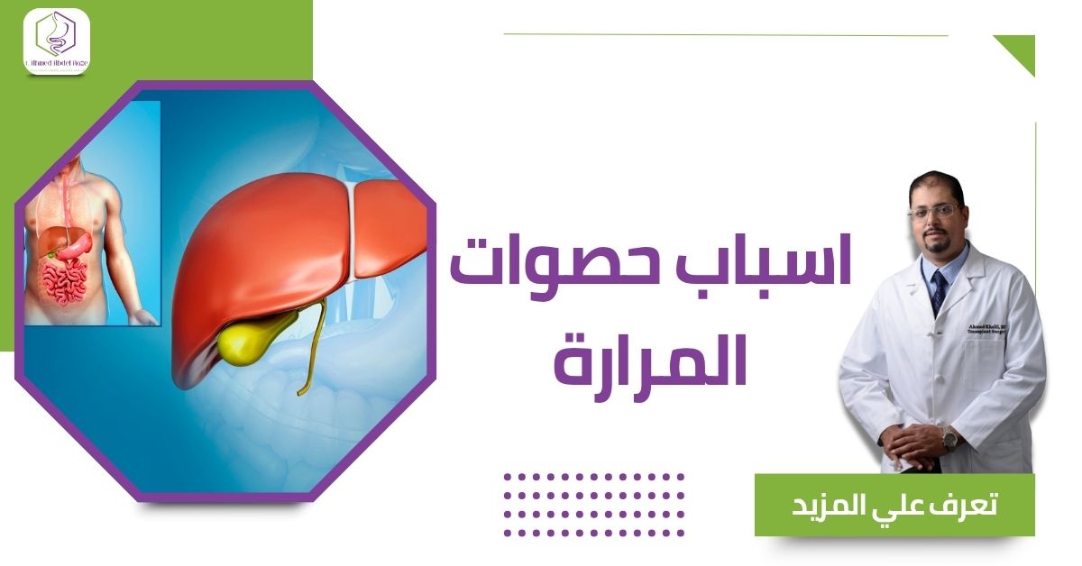اسباب حصوات المرارة