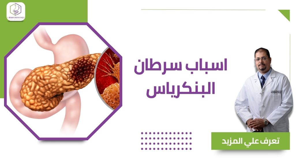 اسباب سرطان البنكرياس