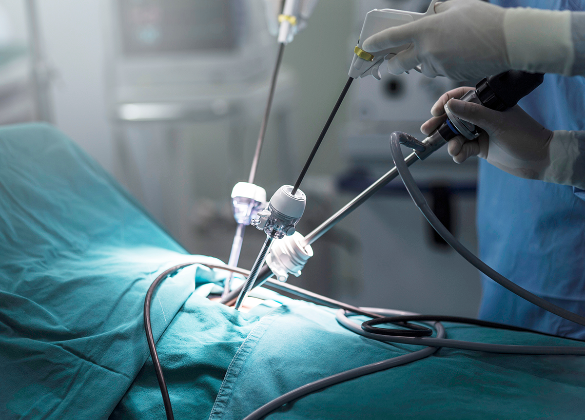 استئصال أورام الكبد بالمنظار