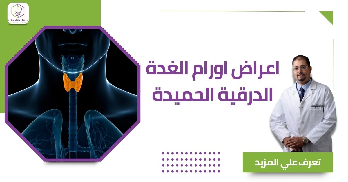 اعراض اورام الغدة الدرقية الحميدة