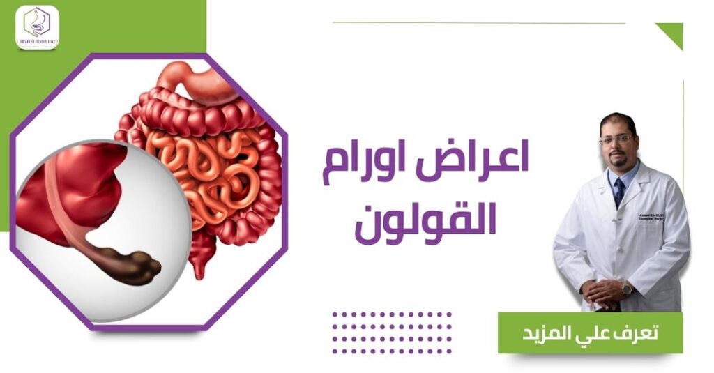 اعراض اورام القولون