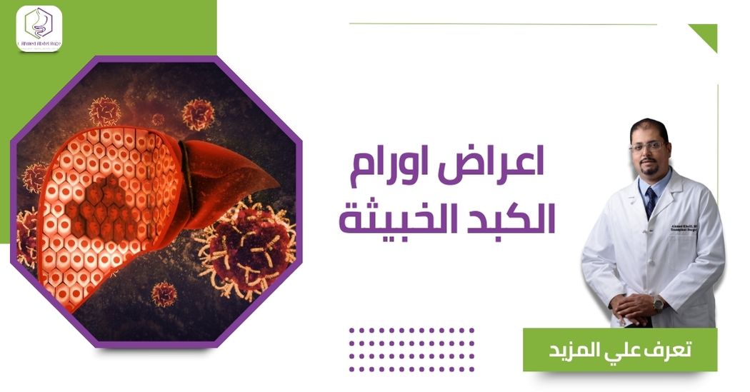 اعراض اورام الكبد الخبيثة