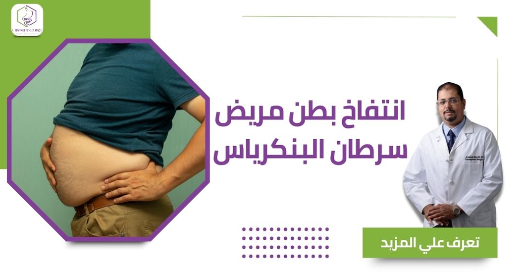 انتفاخ بطن مريض سرطان البنكرياس