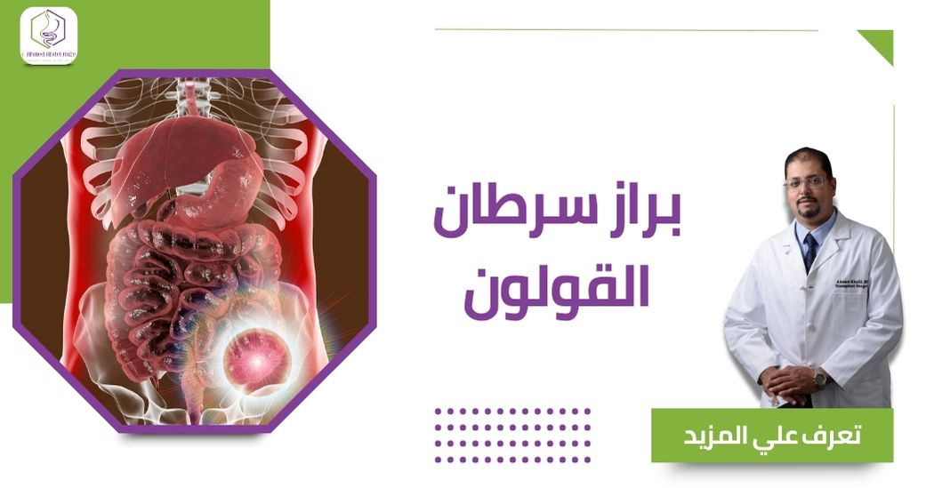 براز سرطان القولون