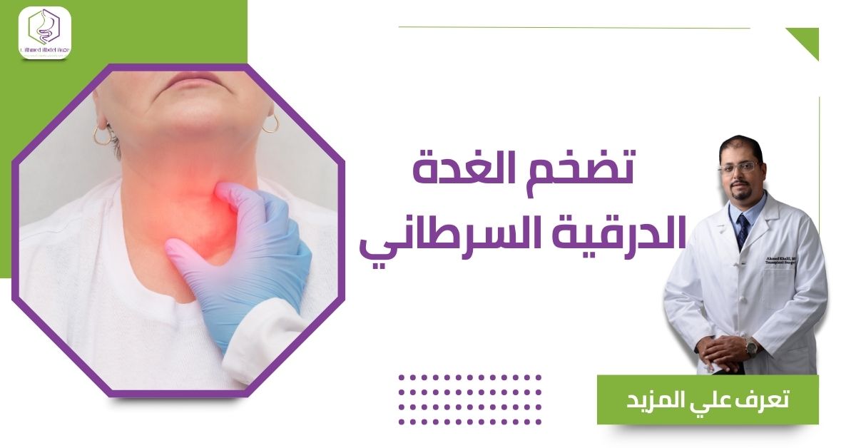 تضخم الغدة الدرقية السرطاني