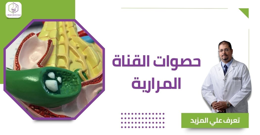 حصوات القناة المرارية