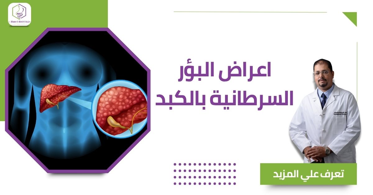 اعراض البؤر السرطانية بالكبد