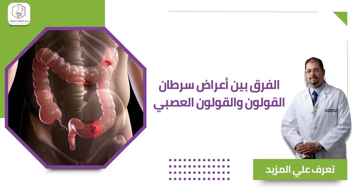 الفرق بين أعراض سرطان القولون والقولون العصبي