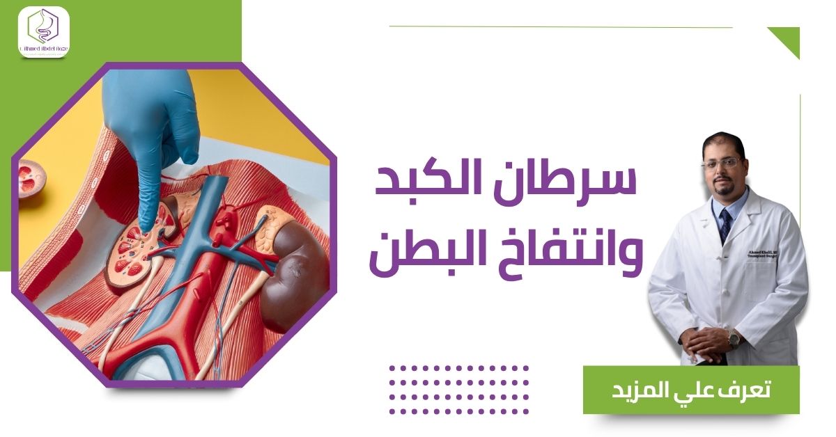 سرطان الكبد وانتفاخ البطن