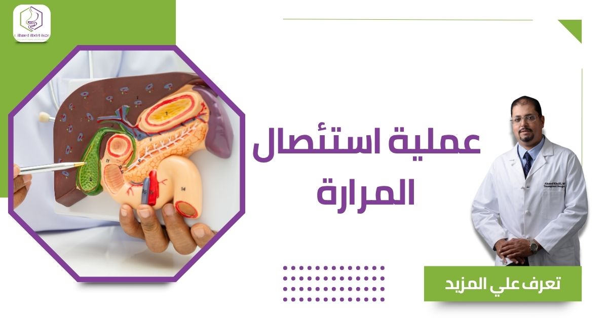 عملية استئصال المرارة