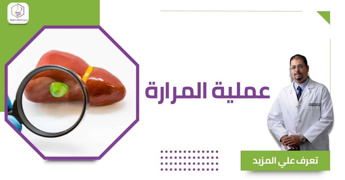 عملية المرارة