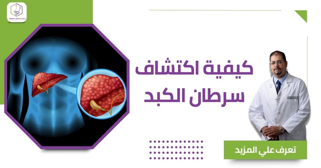 كيفية اكتشاف سرطان الكبد