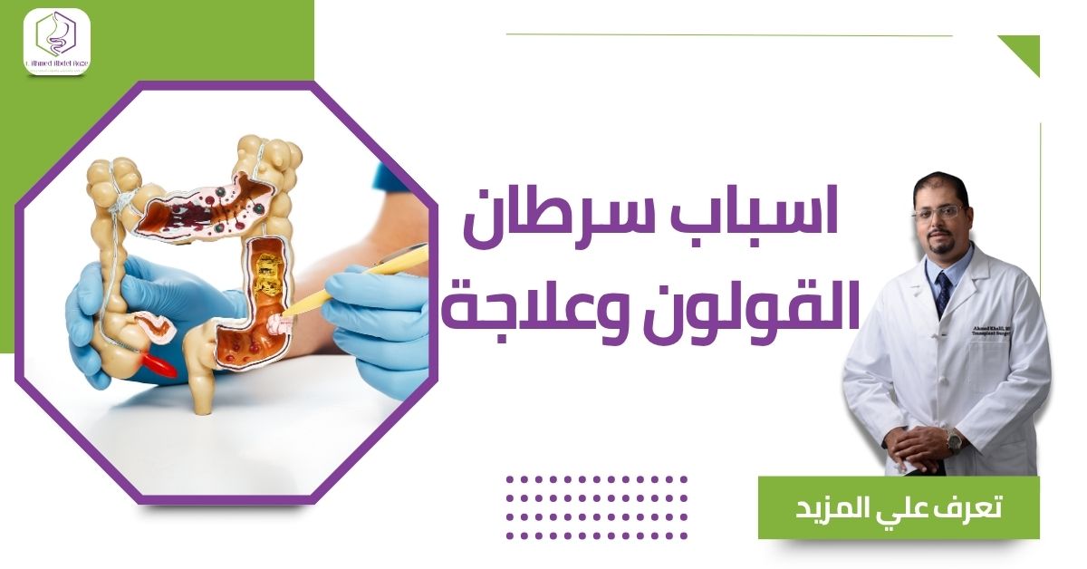 اسباب سرطان القولون وعلاجة