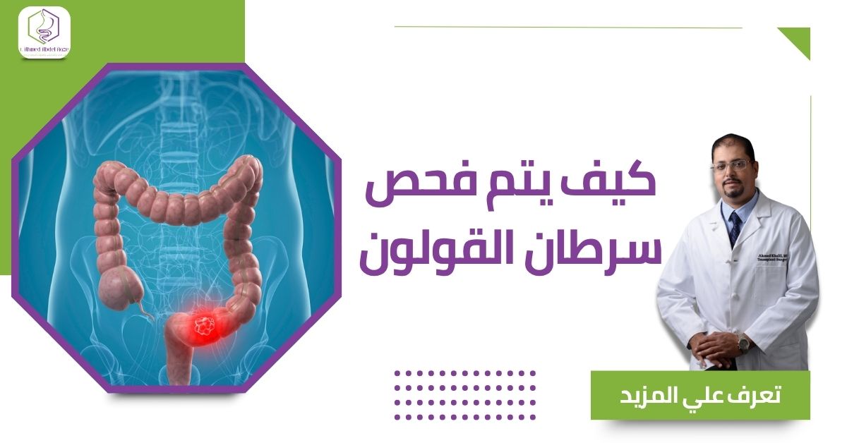 كيف يتم فحص سرطان القولون