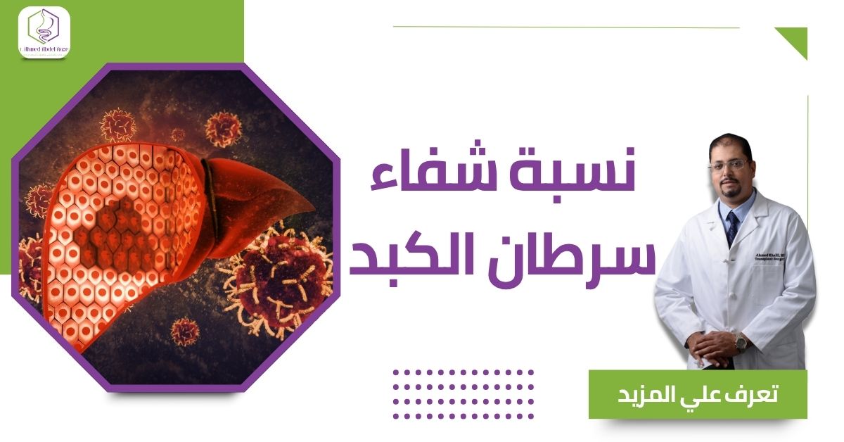 نسبة شفاء سرطان الكبد