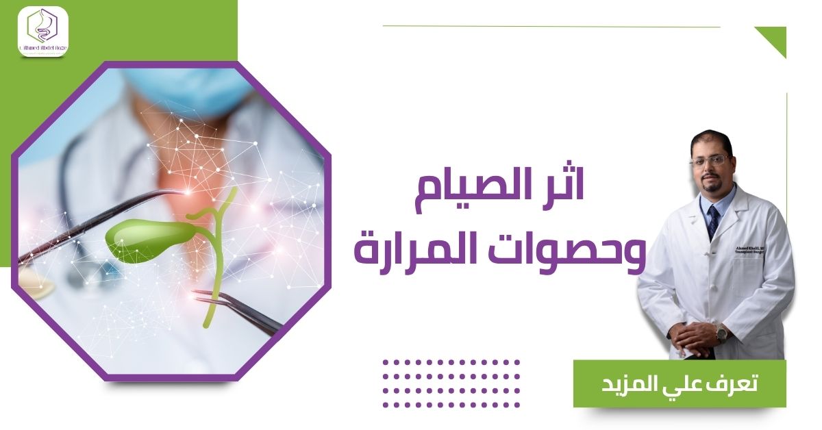 اثر الصيام وحصوات المرارة