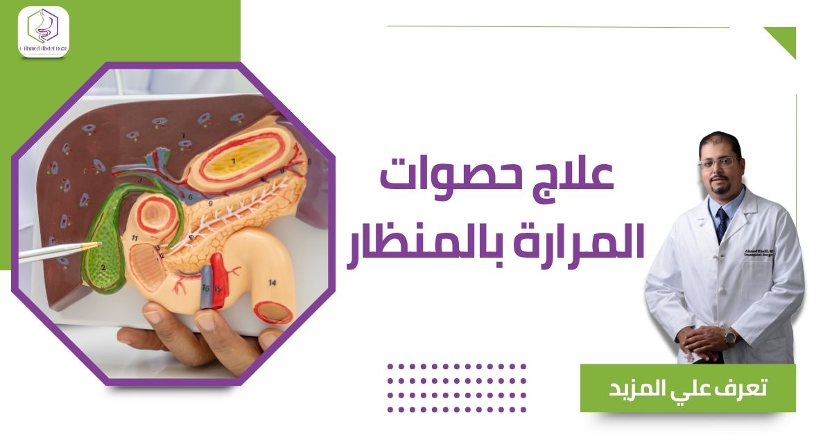 علاج حصوات المرارة بالمنظار