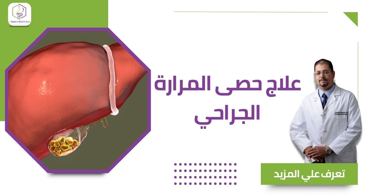 علاج حصى المرارة الجراحي