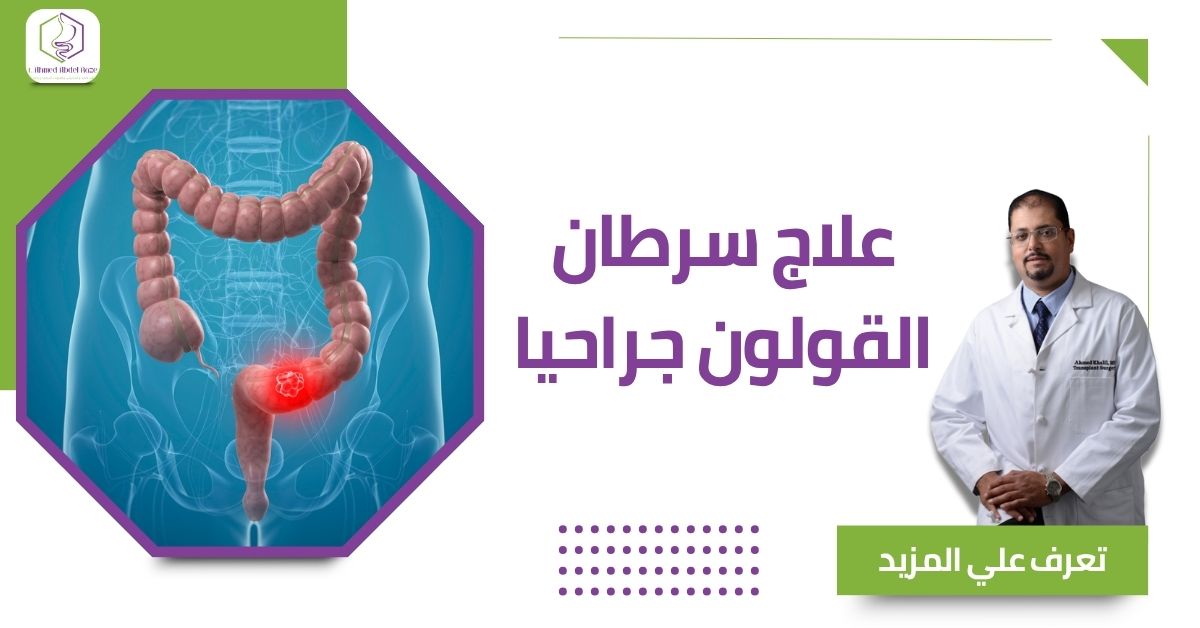 علاج سرطان القولون جراحيا