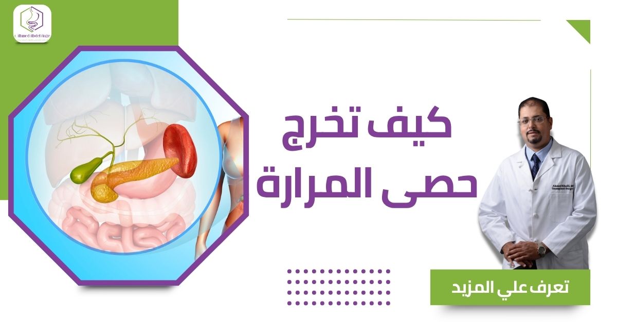 كيف تخرج حصى المرارة