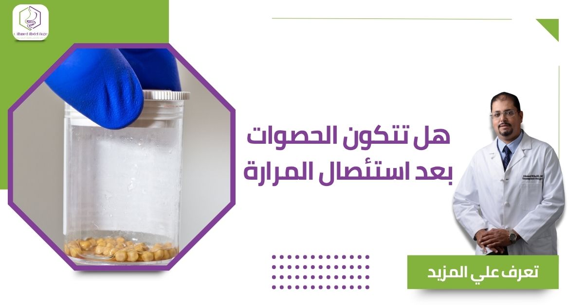 هل تتكون الحصوات بعد استئصال المرارة