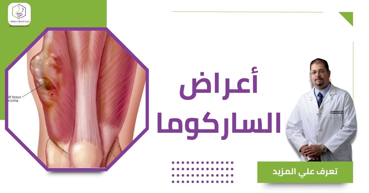 أعراض الساركوما