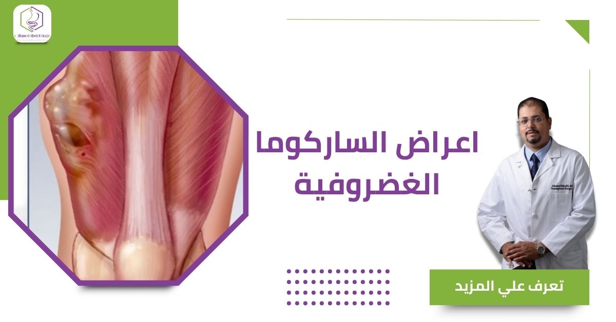 اعراض الساركوما الغضروفية
