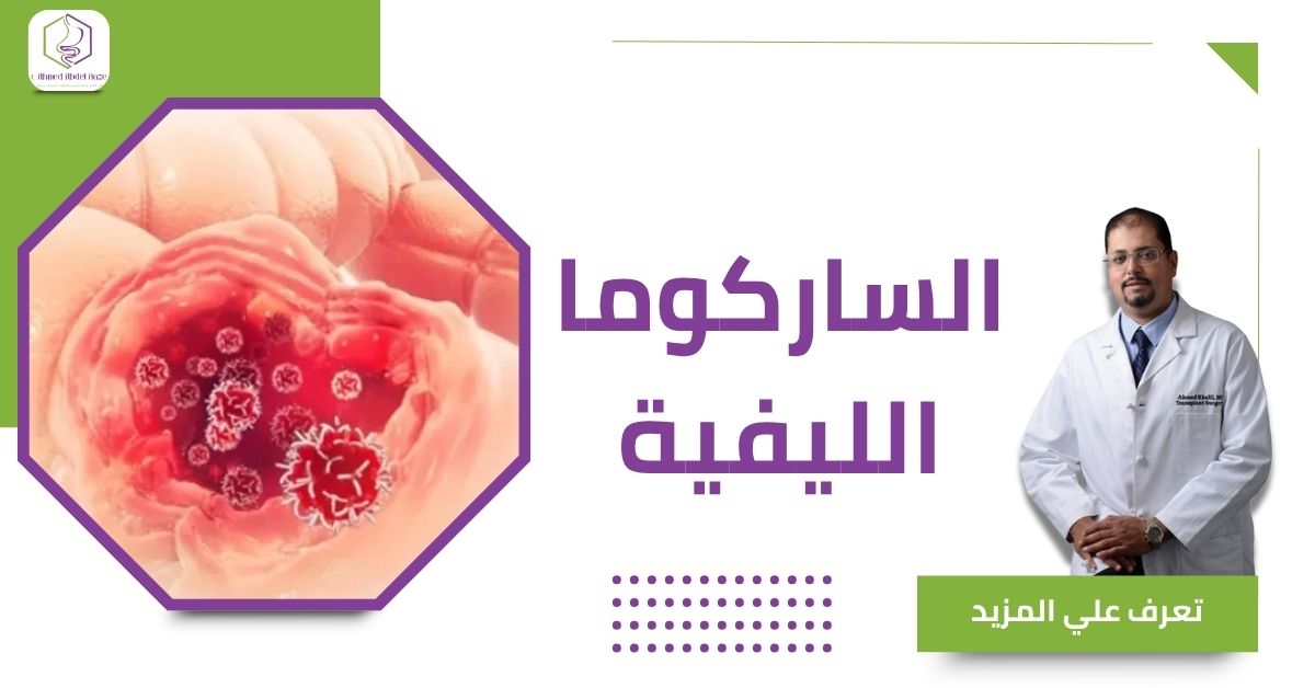 الساركوما الليفية