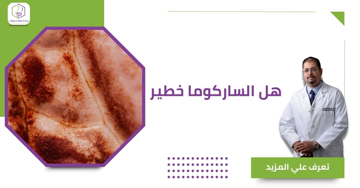 هل الساركوما خطير