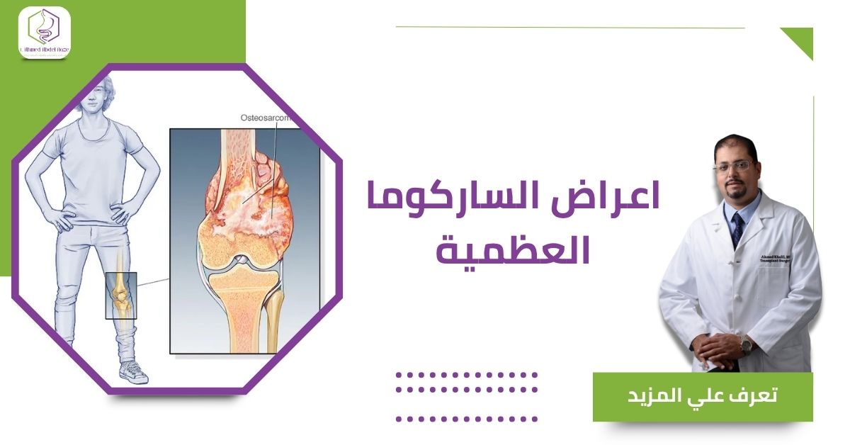 اعراض الساركوما العظمية
