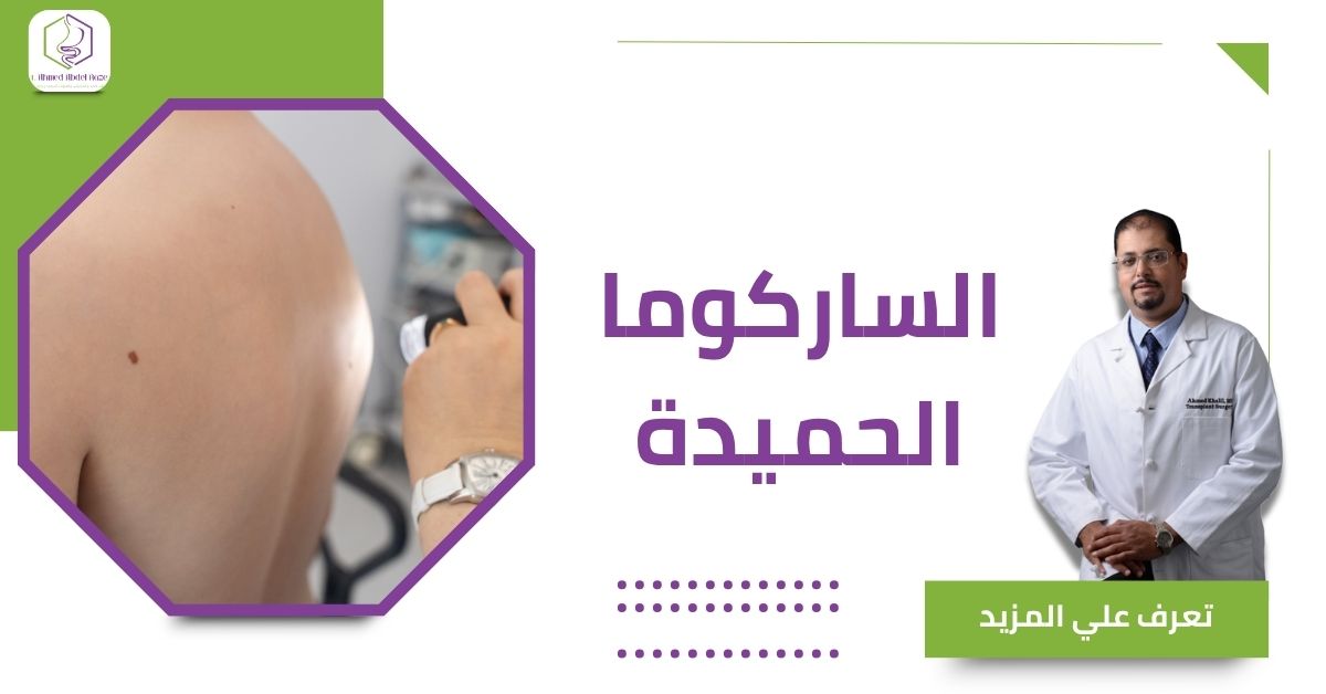 الساركوما الحميدة