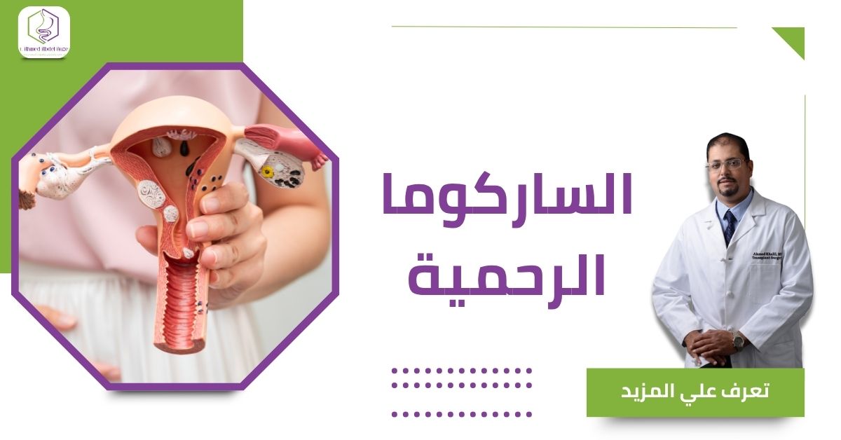 الساركوما الرحمية