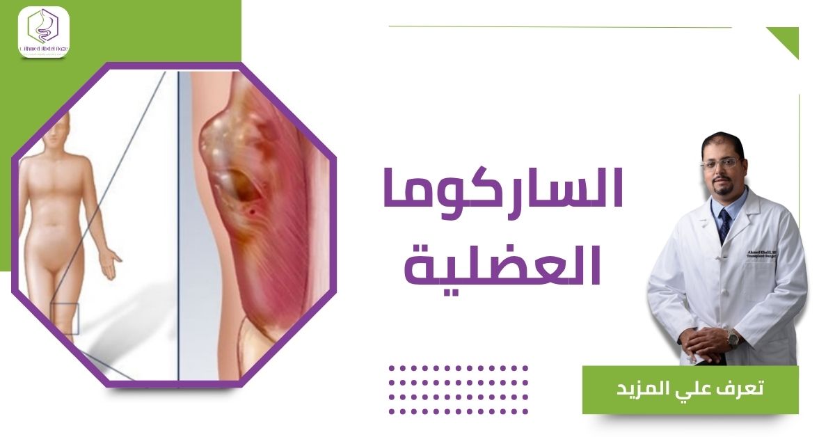 الساركوما العضلية