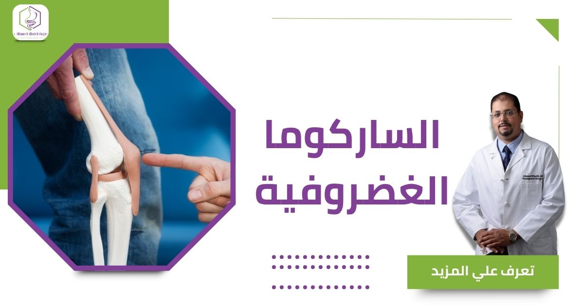 الساركوما الغضروفية