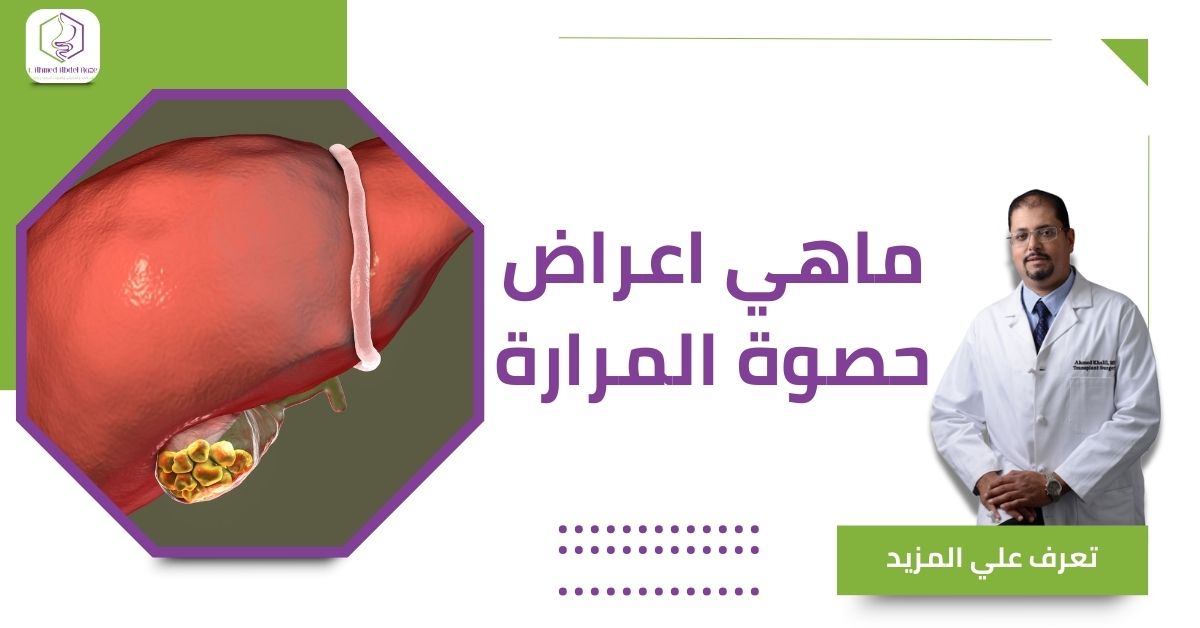 ماهي اعراض حصوة المرارة