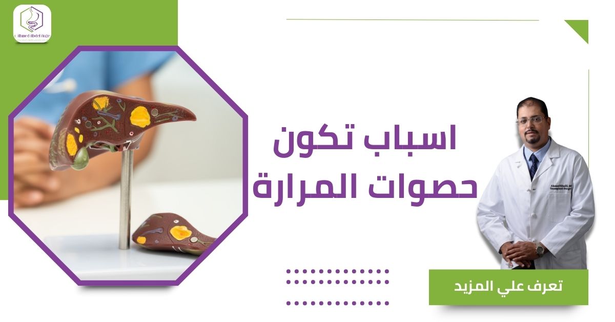 اسباب تكون حصوات المرارة