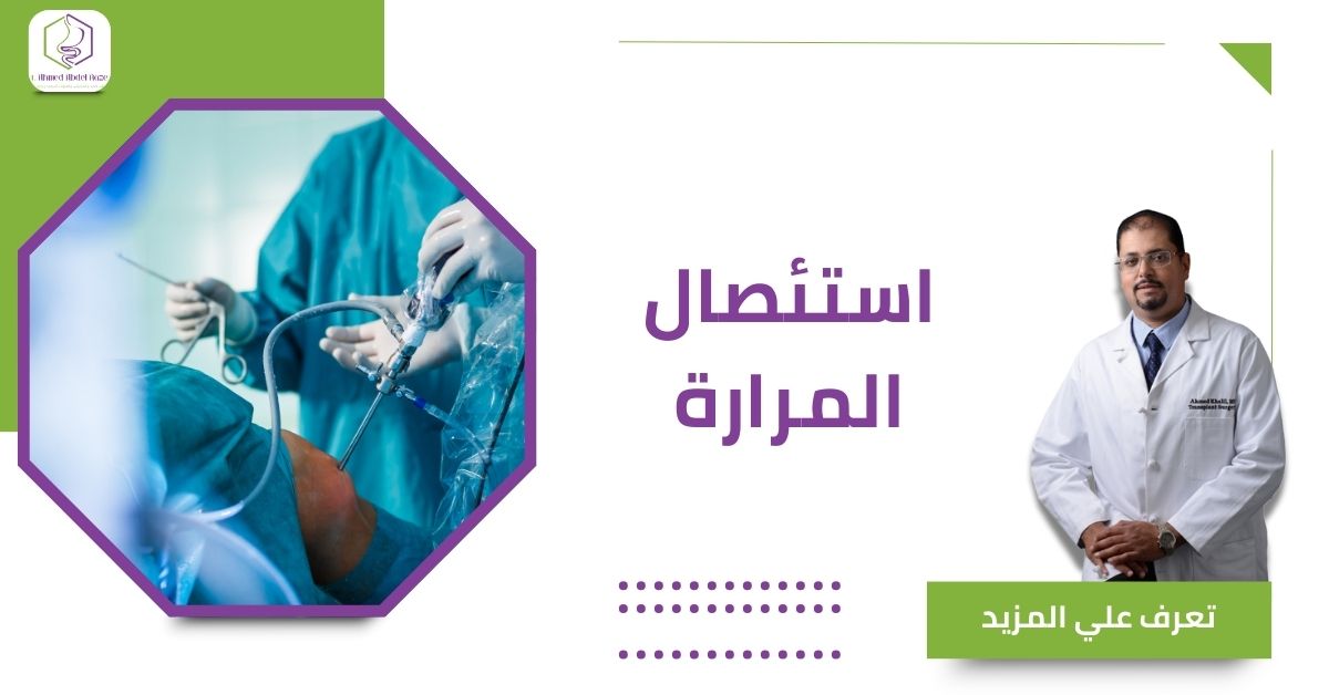 استئصال المرارة