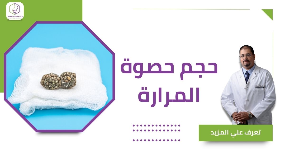 حجم حصوة المرارة