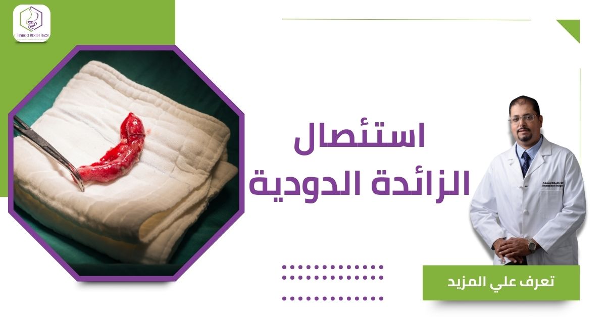 استئصال الزائدة الدودية
