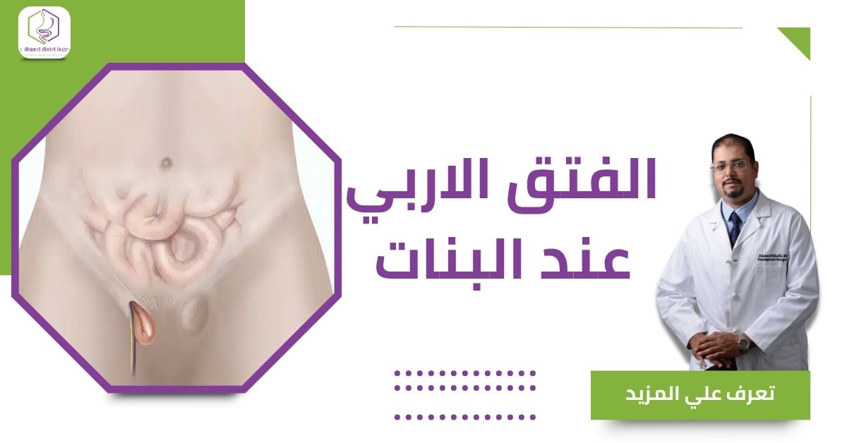 الفتق الاربي عند البنات