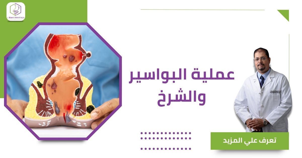 عملية البواسير والشرخ