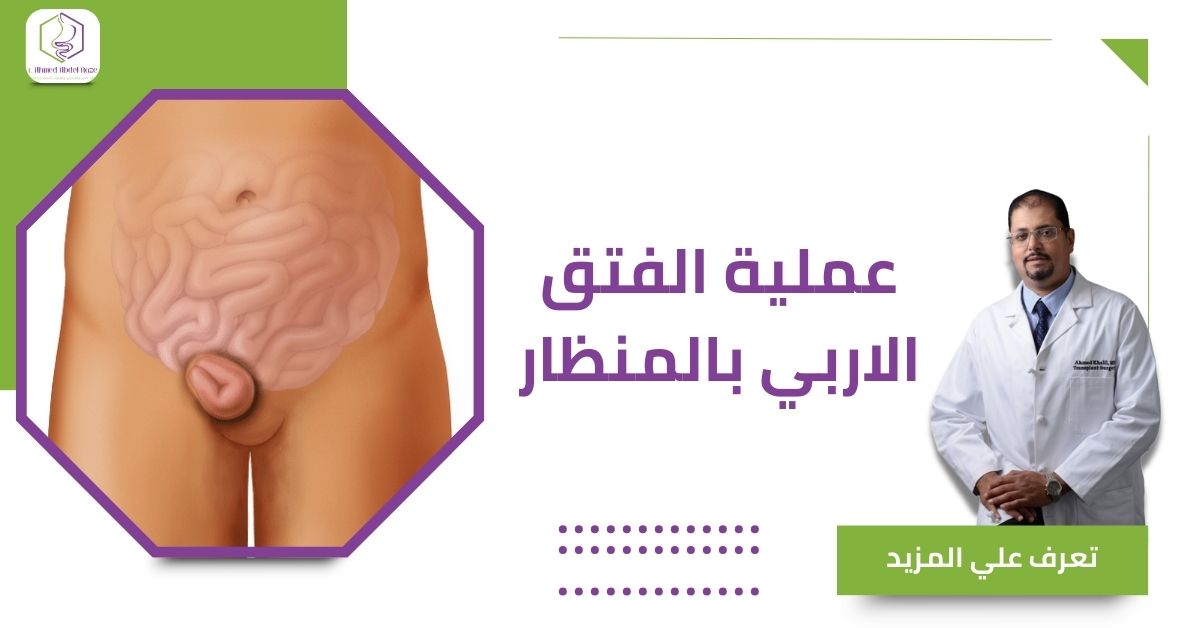 عملية الفتق الاربي بالمنظار