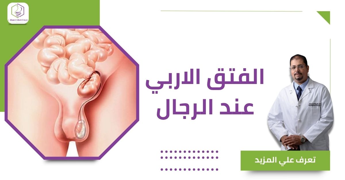 الفتق الاربي عند الرجال