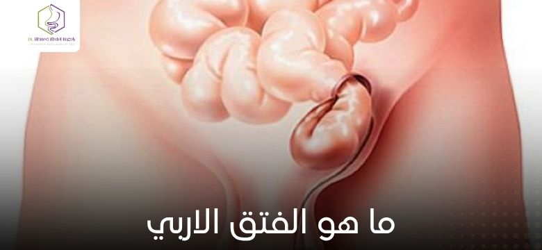 ما هو الفتق الاربي