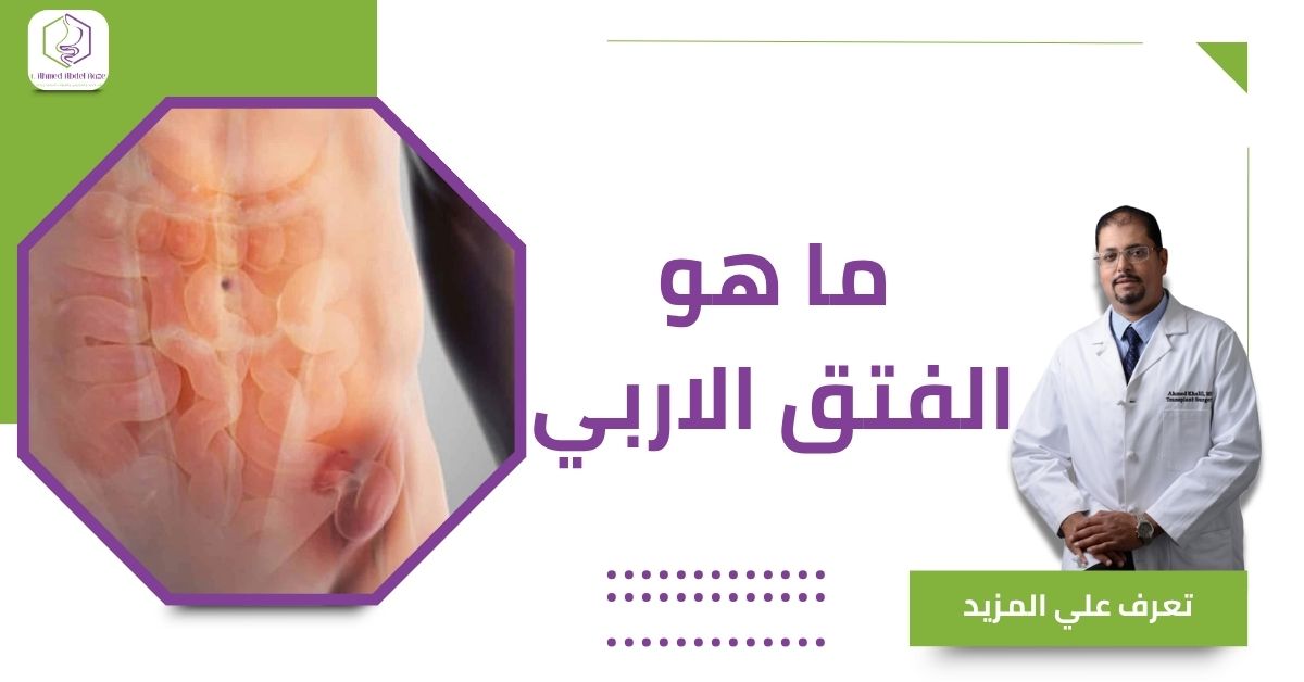 ما هو الفتق الاربي