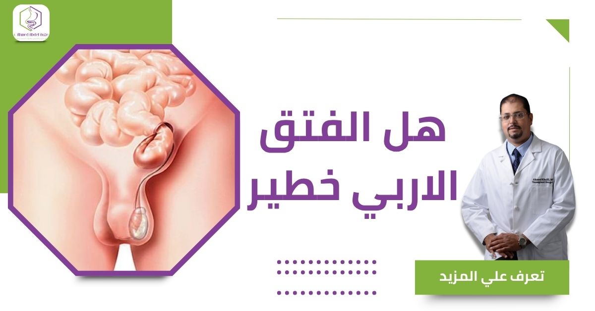 هل الفتق الاربي خطير