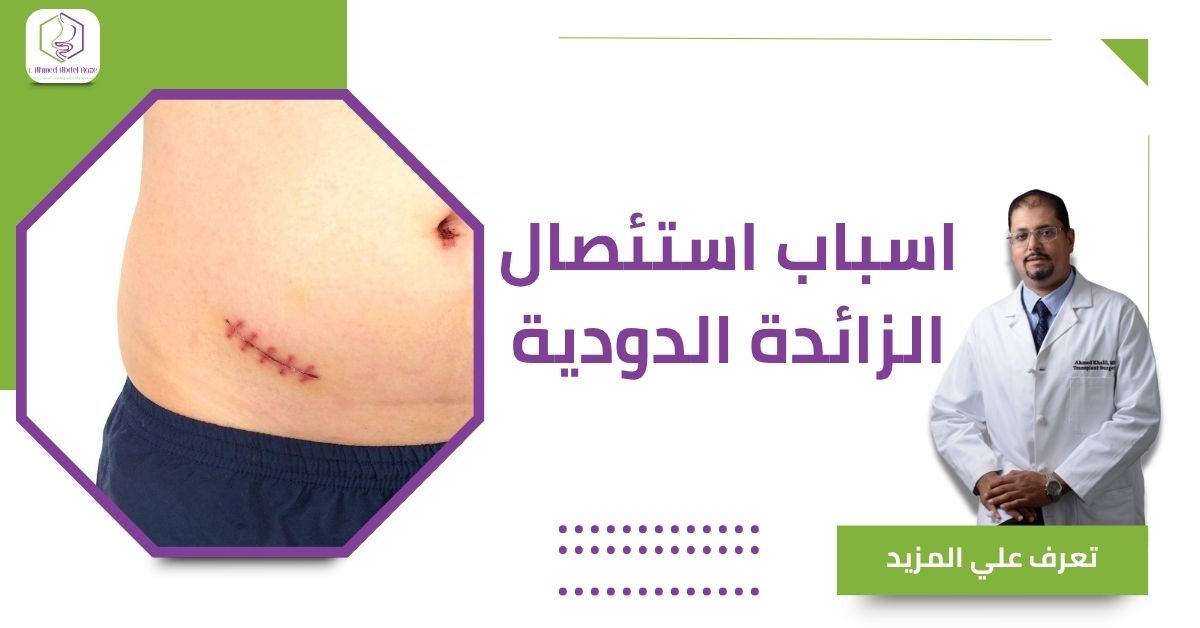 اسباب استئصال الزائدة الدودية