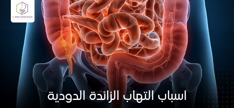 اسباب التهاب الزائدة الدودية