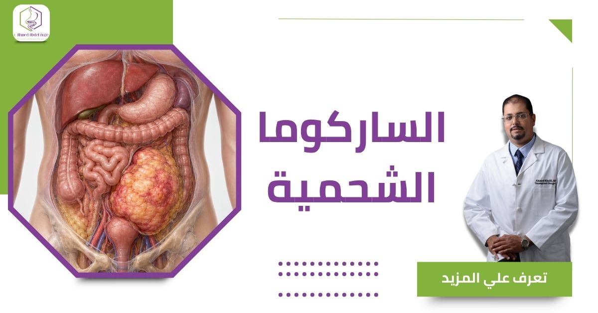 الساركوما الشحمية